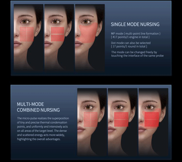 beauty salon portable hifu machine facial lift