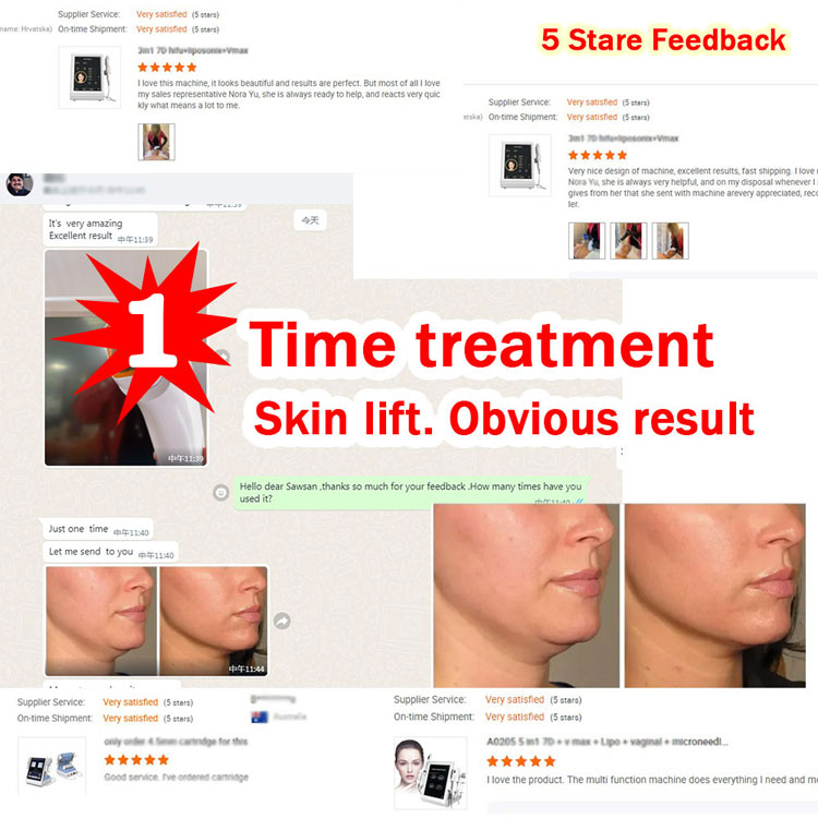 9D Hifu Body Slimming Skin Tightening Beauty Machine