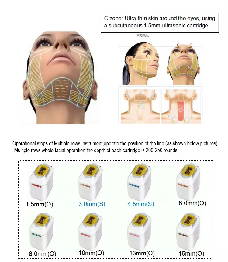 hifu rf ultrasonic facial machine