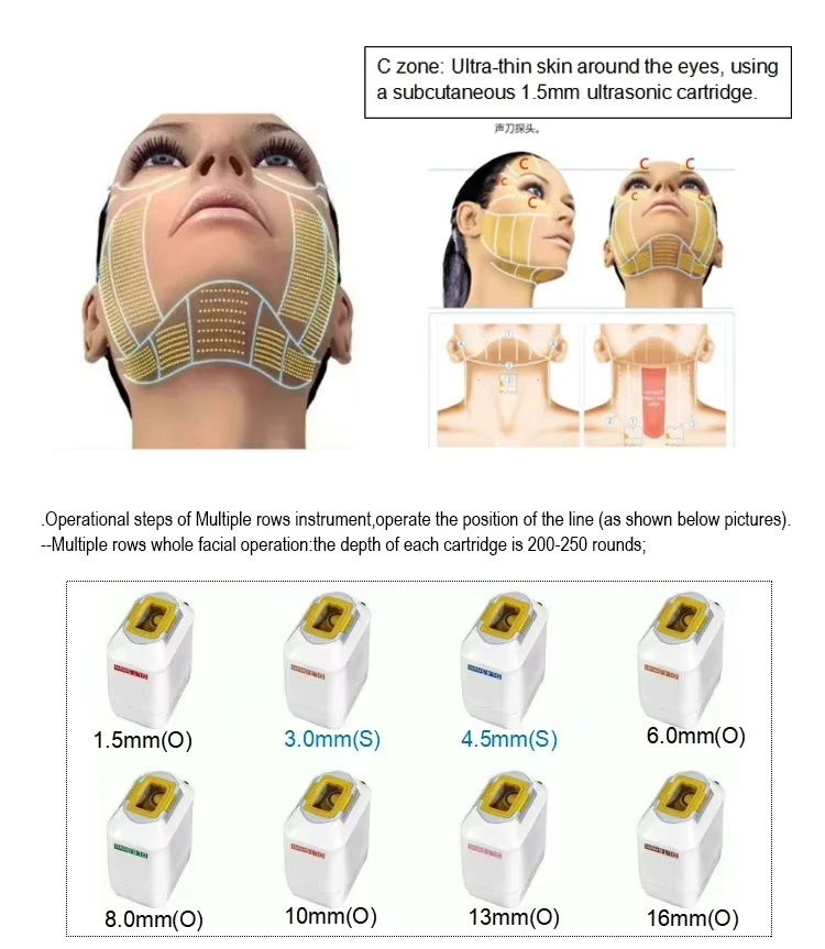 hifu facial machine cost