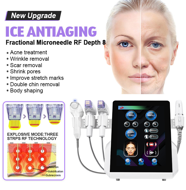 Ultrasonic Anti Aging Beauty Device01