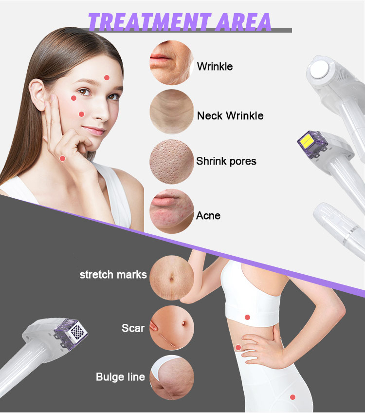 Ultrasonic Anti Aging Beauty Device02