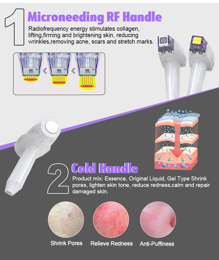 Ultrasonic Anti Aging Beauty Device04