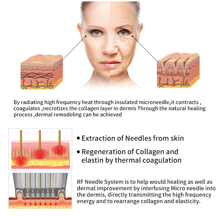 Ultrasonic Anti Aging Beauty Device06