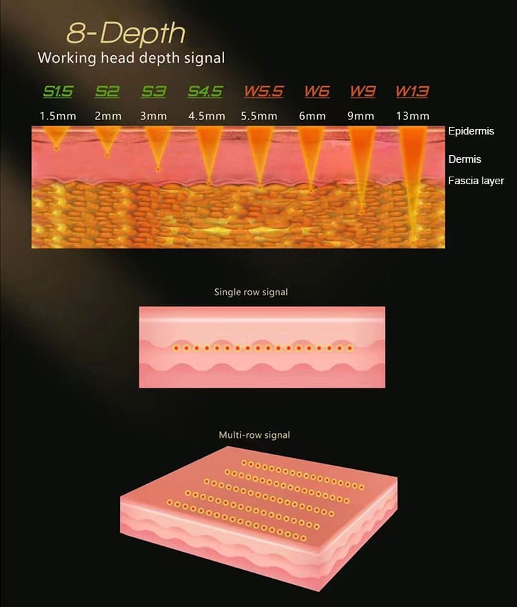 hifu machine for face and neck