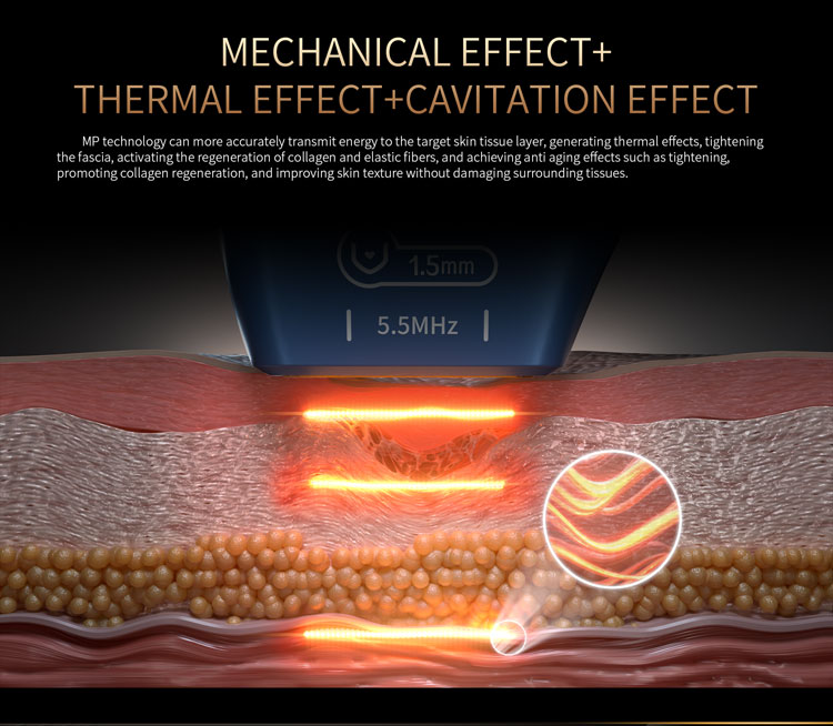 360 Rotation 7D Hifu machine