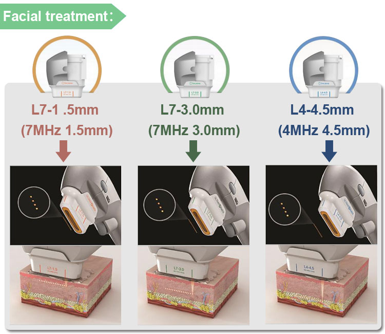 Portable 7d hifu ultrasound face lift skin tightening machine for sale