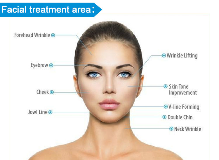 ultherapy skin lifting