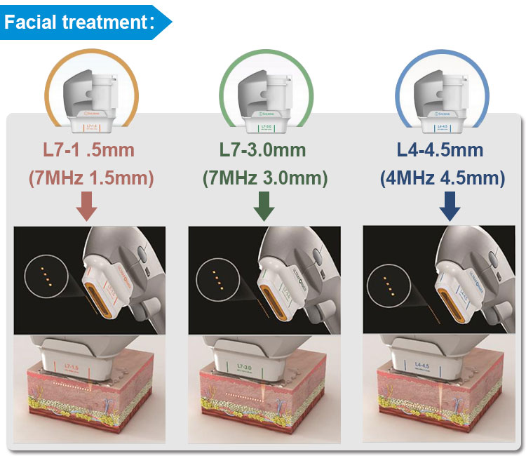 ultrasound skin tightening cost