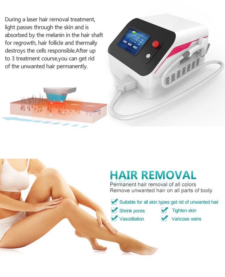 diode laser hair removal 808nm