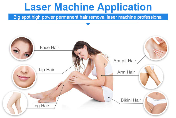 professional laser hair removal machines