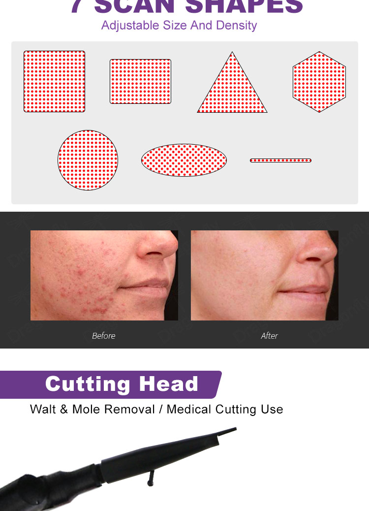 skin rejuvenation CO2 laser system05