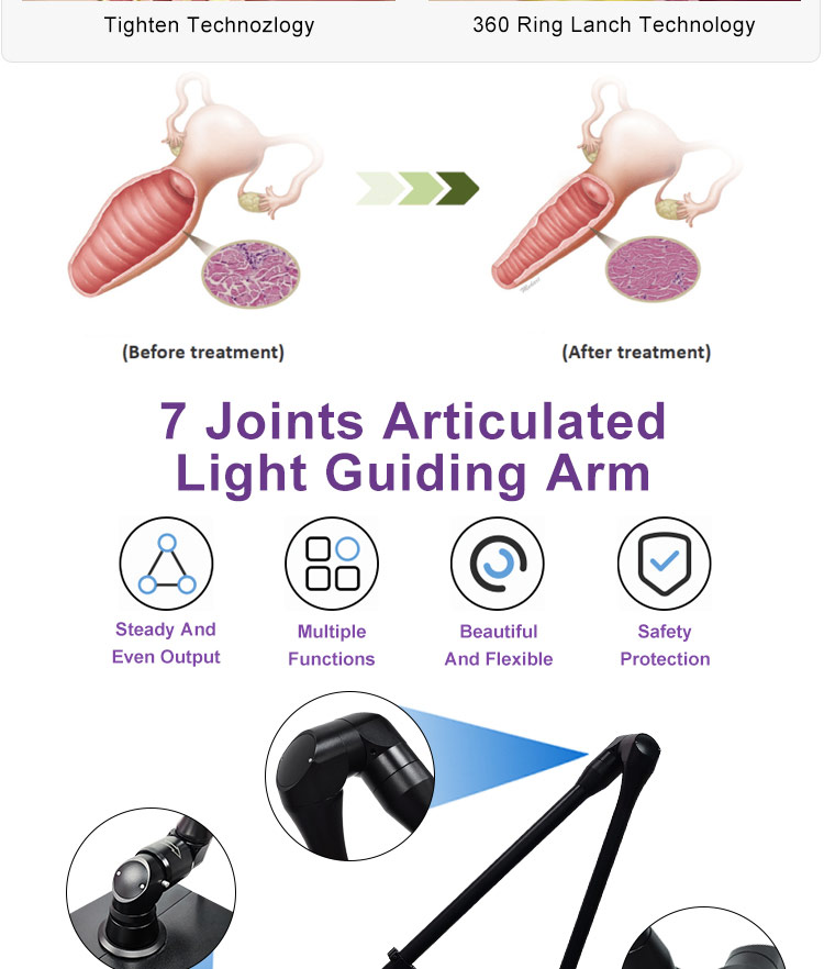 skin rejuvenation CO2 laser system07