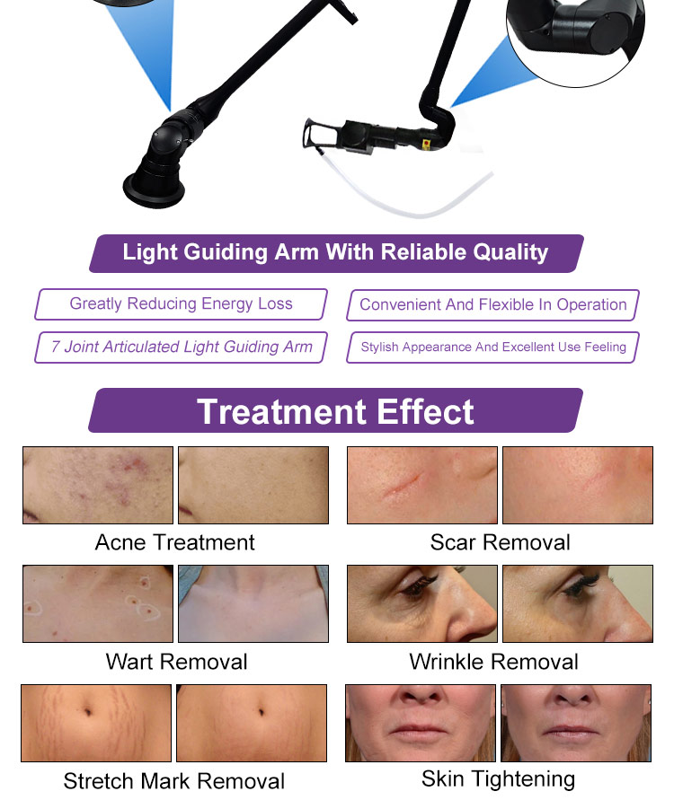 skin rejuvenation CO2 laser system08