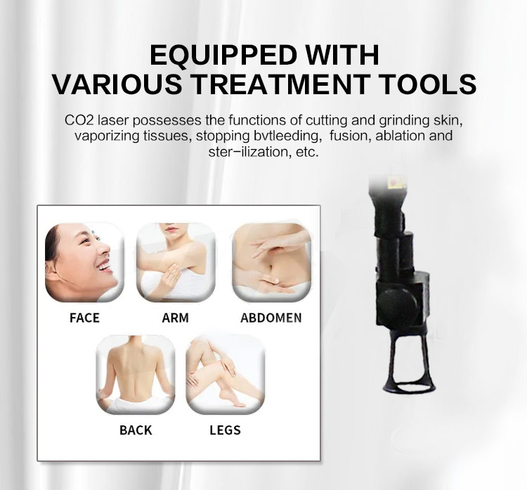 skin rejuvenation CO2 laser system10