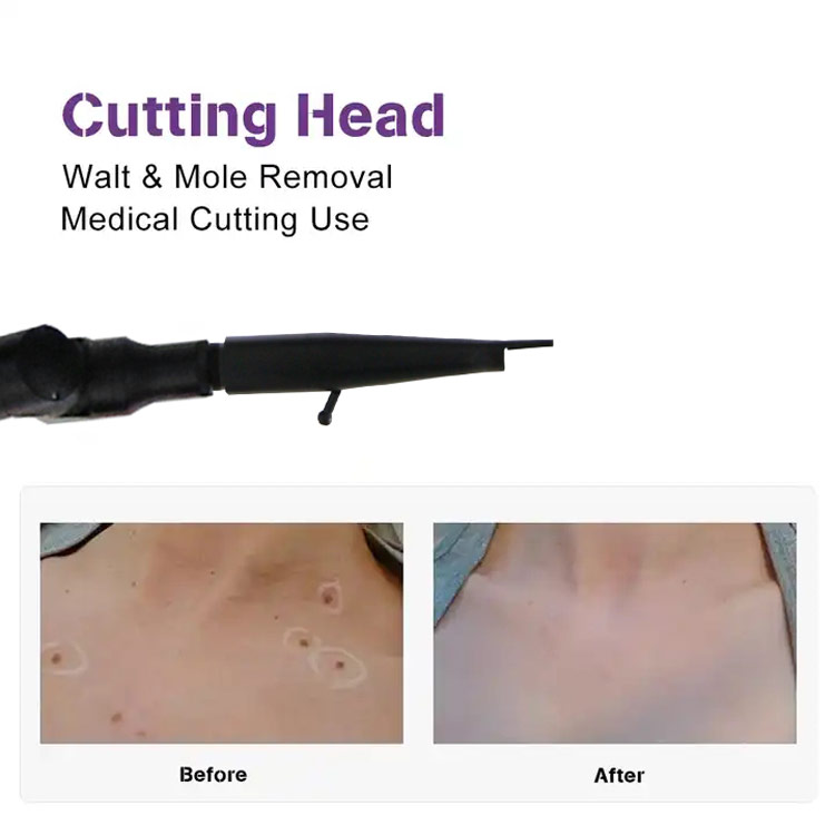 skin rejuvenation CO2 laser system14