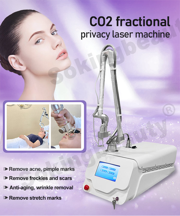 cost of co2 laser machine01