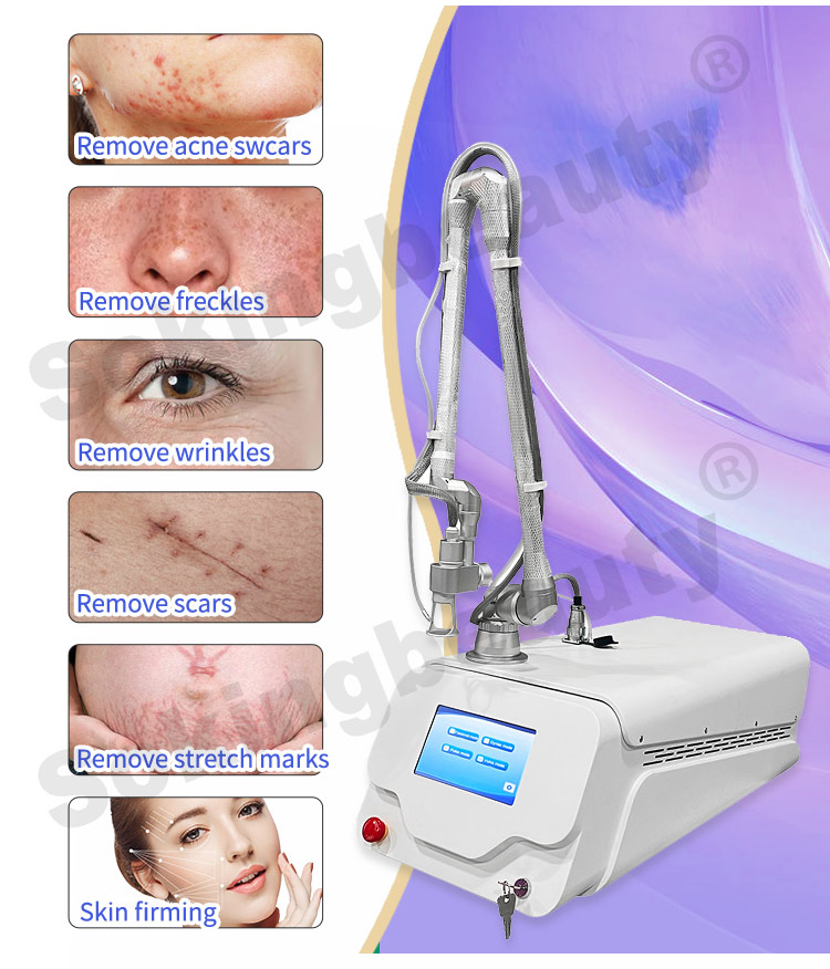 cost of co2 laser machine02