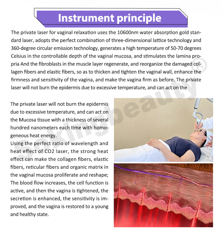 cost of co2 laser machine03