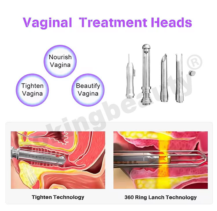cost of co2 laser machine05