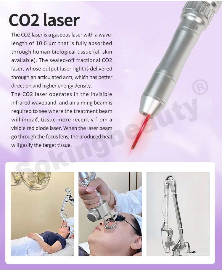 cost of co2 laser machine08