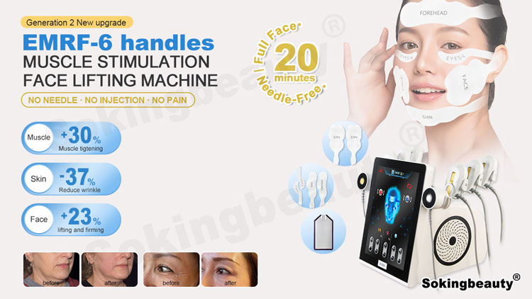RF facial skin tightening machine