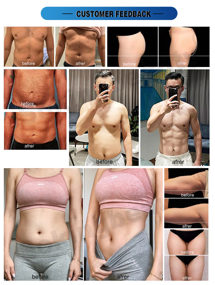 hiemt body sculpt before and after