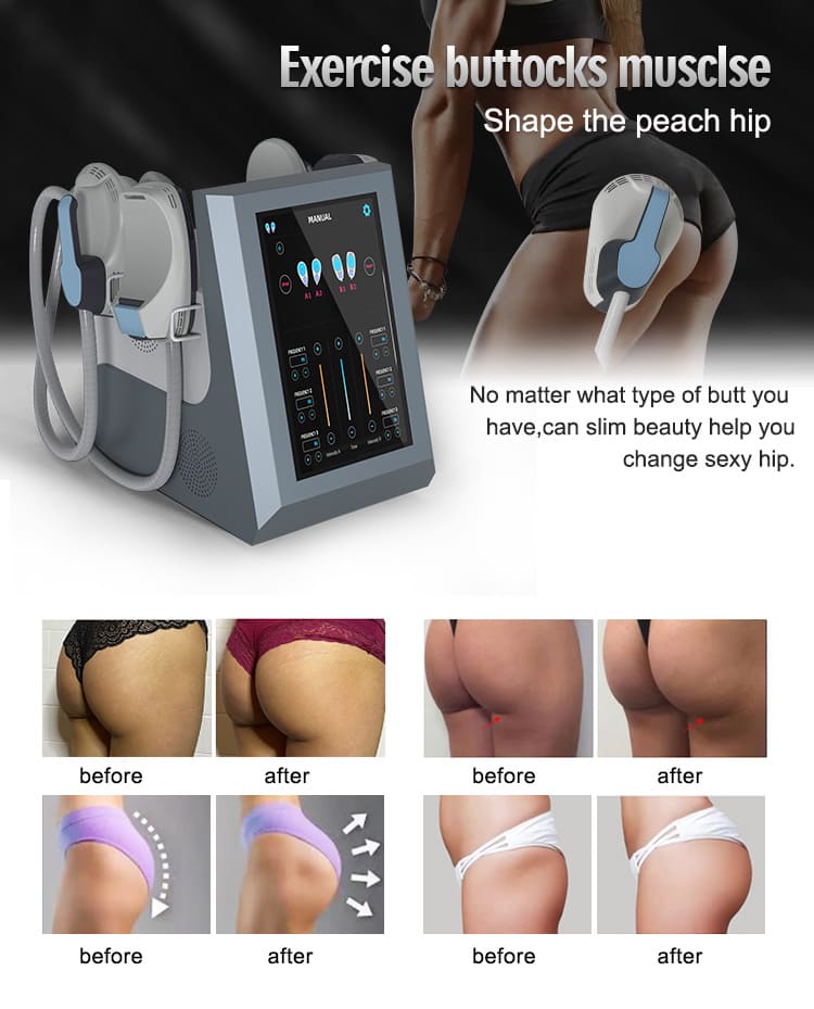 ems shaping sculpting device