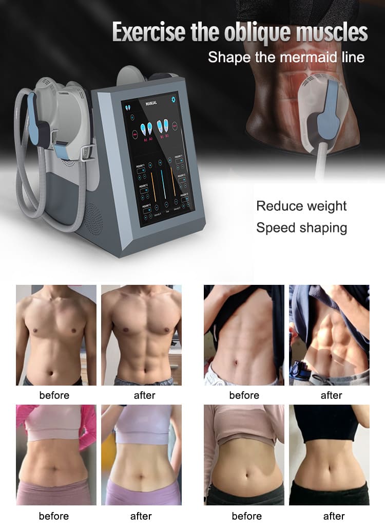 rf ems sculpting machine