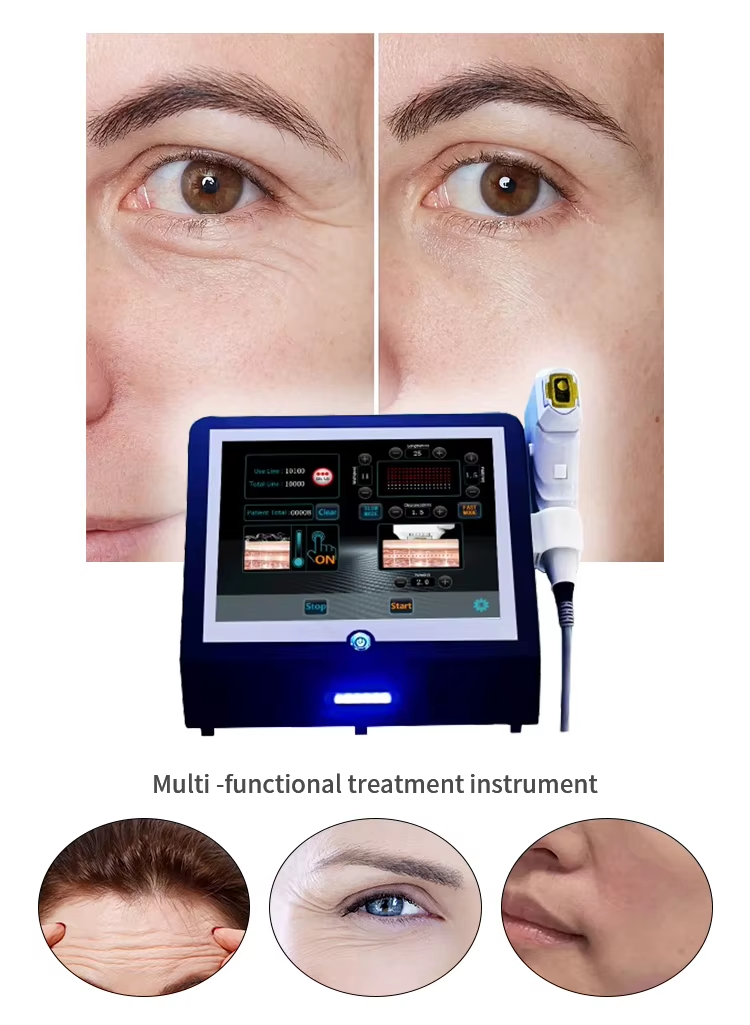 cold hifu machine cost