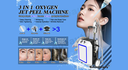 Oxygen Jet Peel Machine