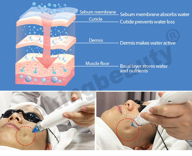 Oxygen Spray Machine09