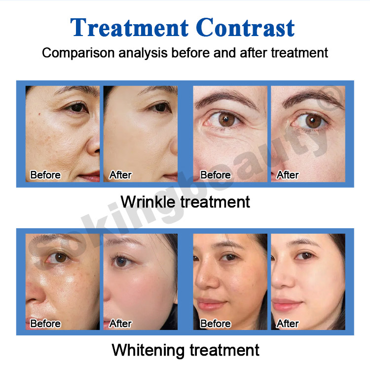 Oxygen Spray Machine13