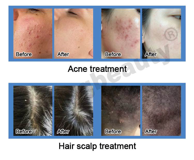 Oxygen Spray Machine14