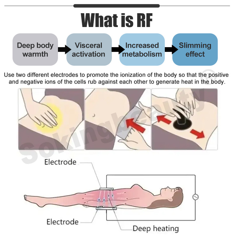 tecar therapy equipment08