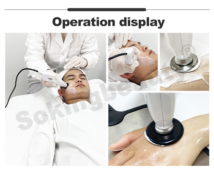 tecar therapy equipment11