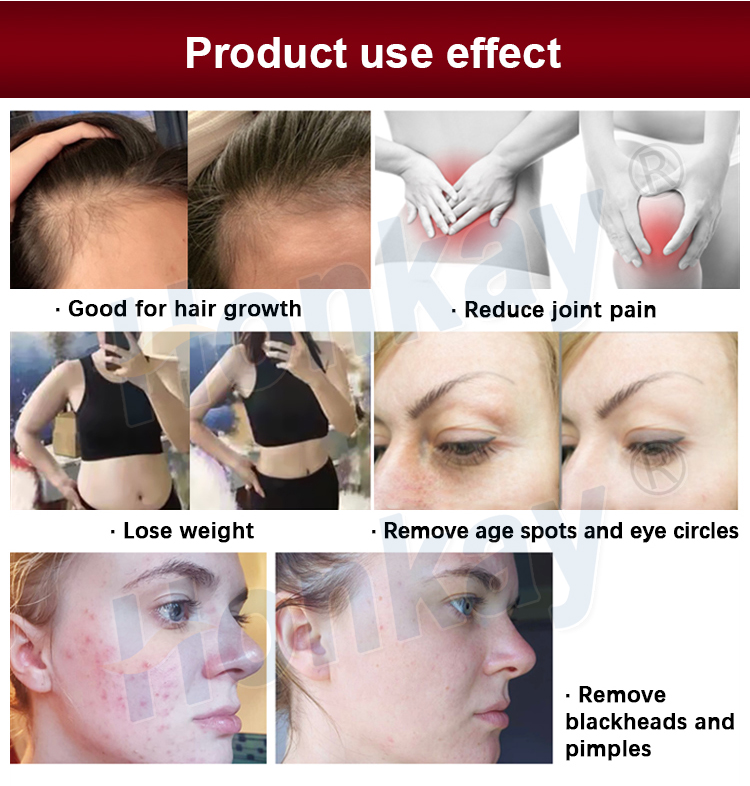 hair removal machine commercial