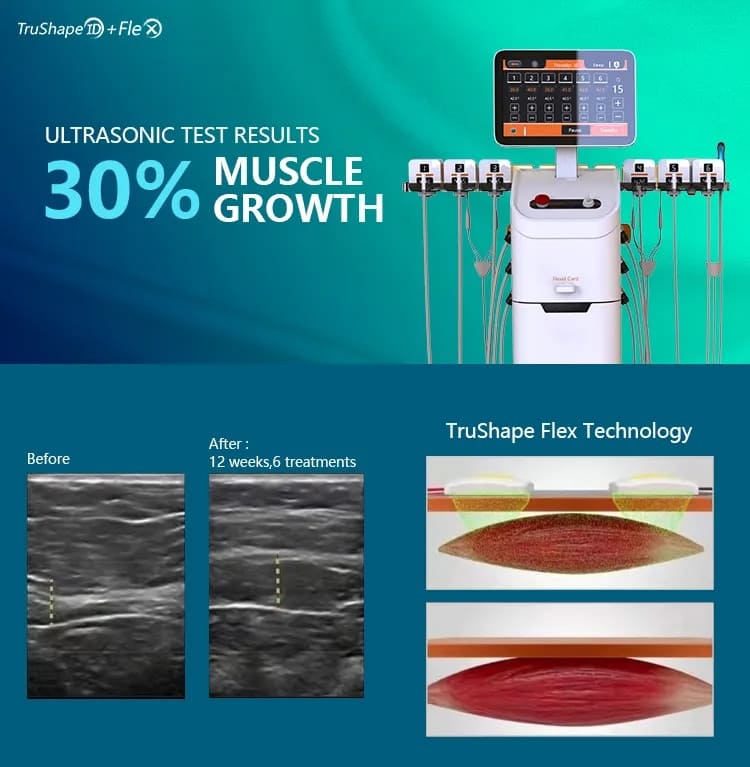 trusculpt flex machine