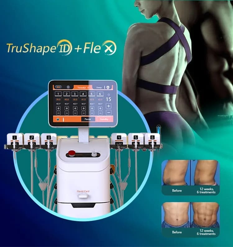 trusculpt id