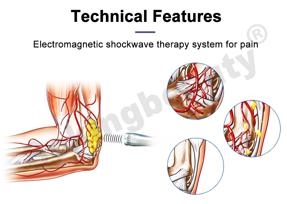 Shockwave Therapy Equipment