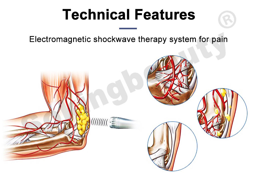 Shock Wave Magnetic Electronic Therapy equipment