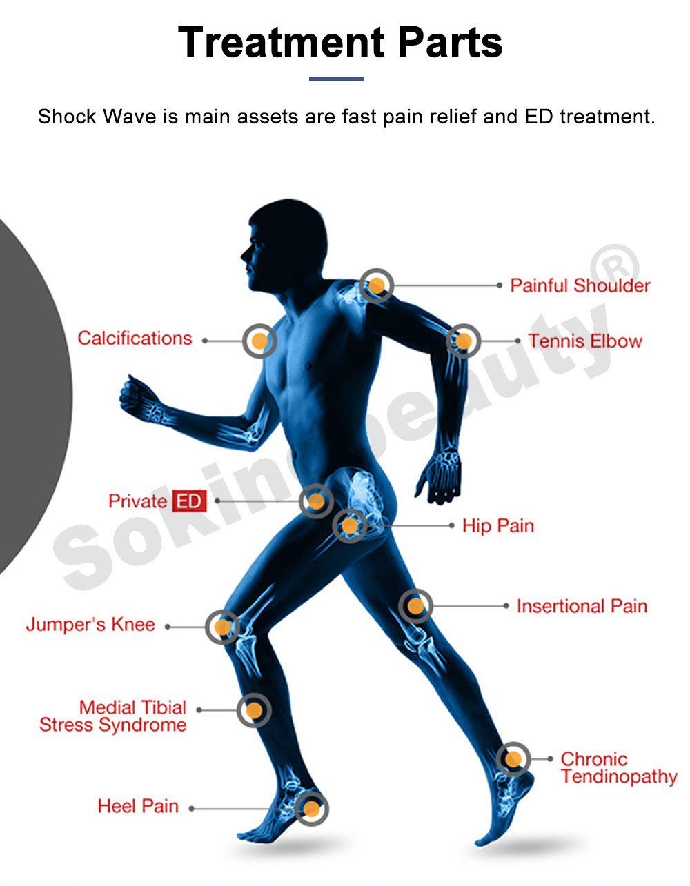 Shockwave Therapy equipment