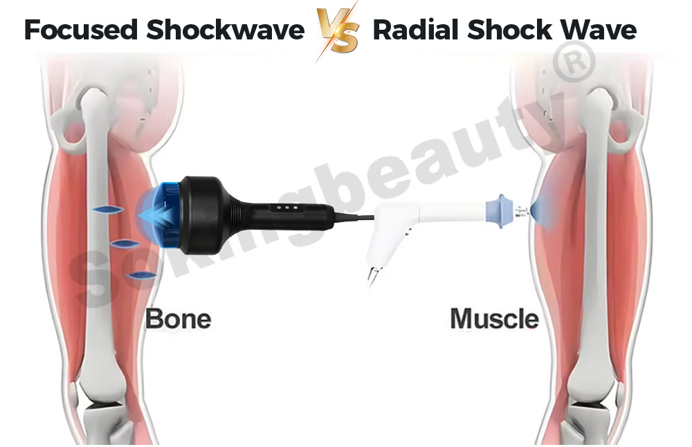 66mm depth focused shockwave device
