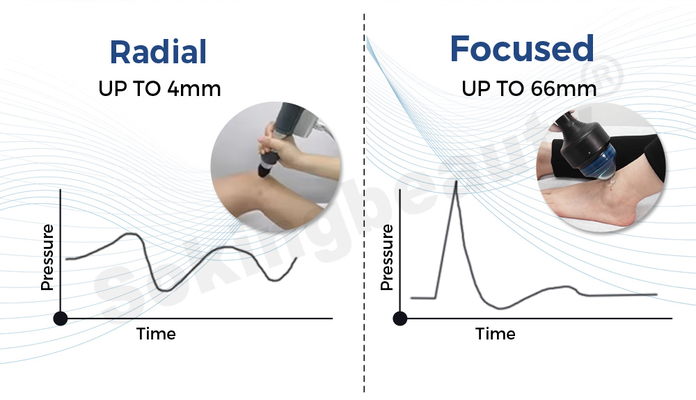 66mm depth focused shockwave equipment