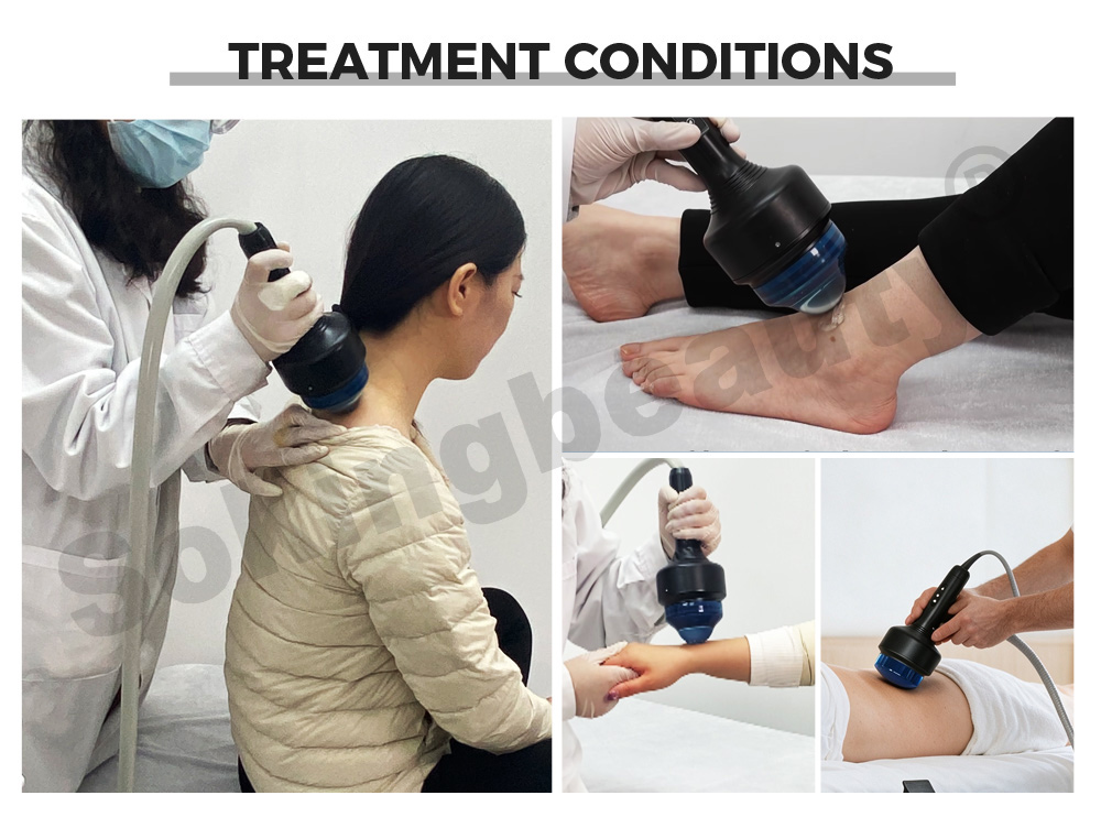 Trolley‑Case Focused Shockwave Therapy Machine
