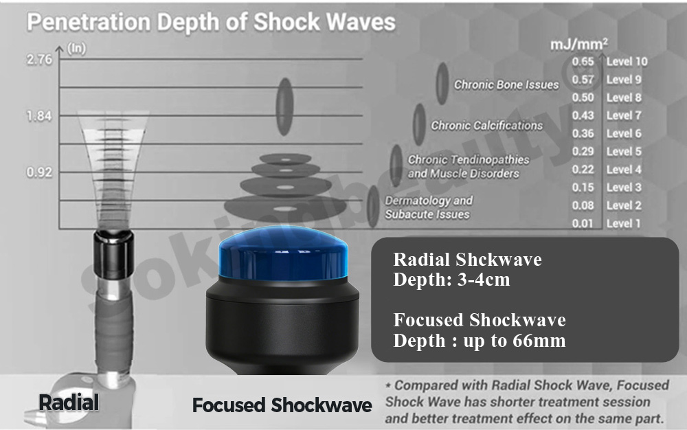 focused shockwave machine For Rehabilitation