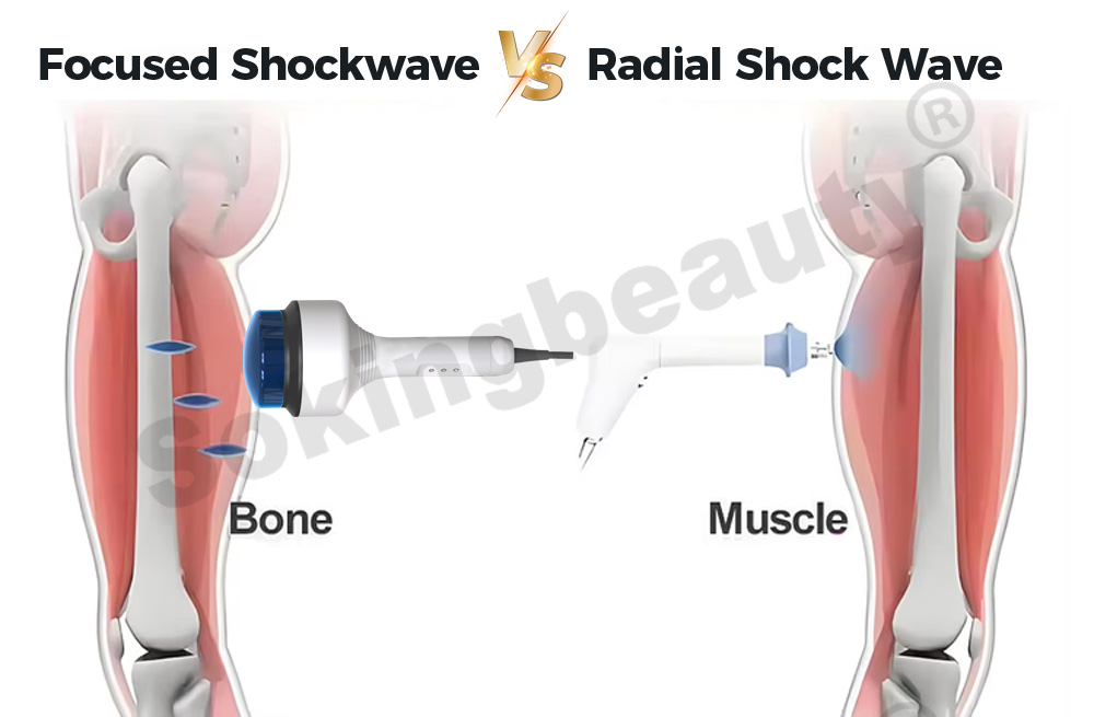 vertical shockwave device for wellness clinic