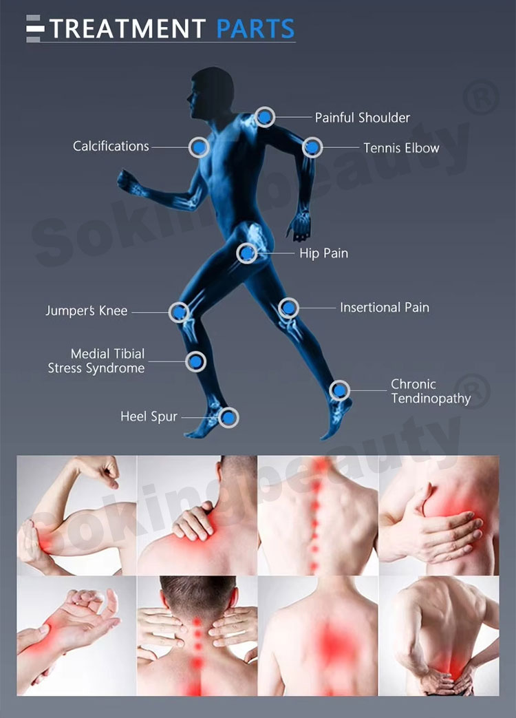 broad focused shockwave therapy machine