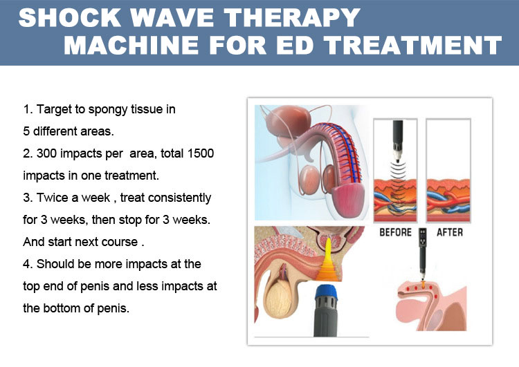 shock wave for ed