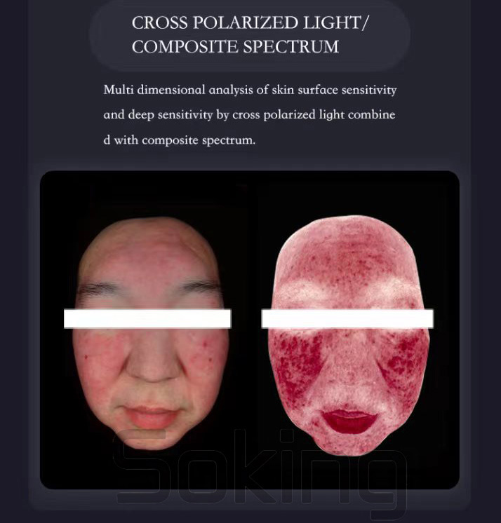 skin analysis machine